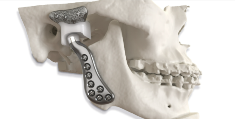 Why Treatment Matters