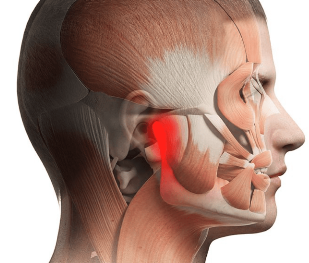 TMJ Disorders
