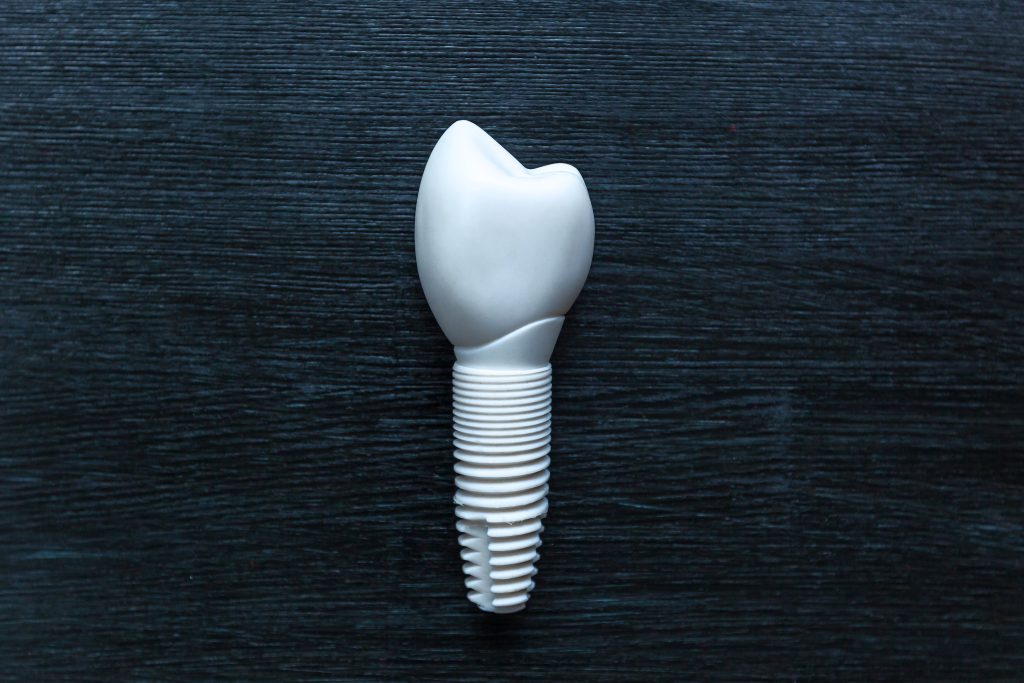 Zirconia Implants